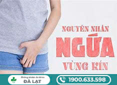 Hình ảnh minh họa